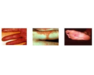 Ni releases检测|镍释放量检测